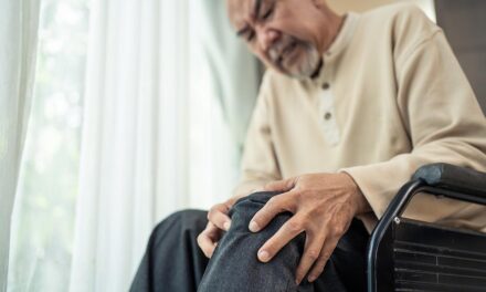 Osteoartritis de rodilla ¿Qué es? Y tratamiento en caso de padecerla