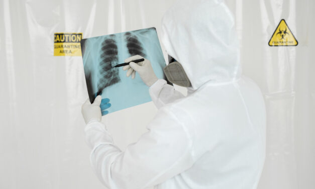 TUBERCULOSIS